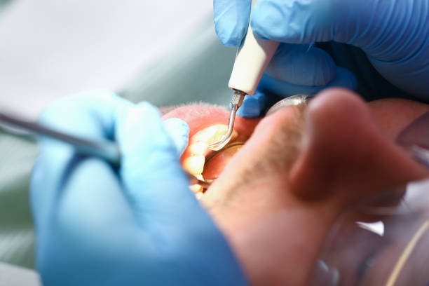 Best After-Hours Dental Trauma Care in Massanetta Springs, VA